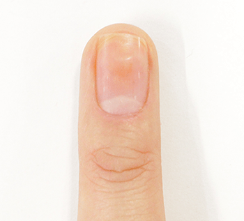 PIKICAST | 叛亂熊