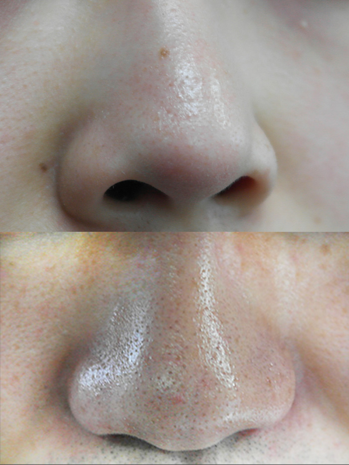 Pikicast版權所有