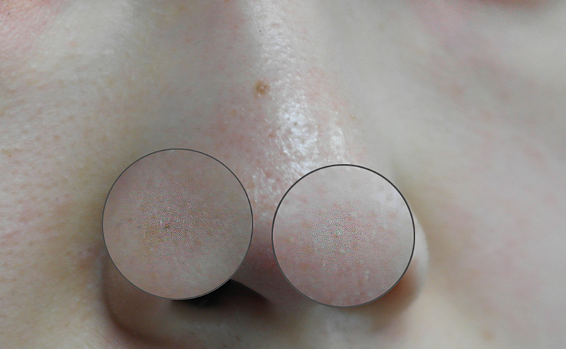 Pikicast版權所有