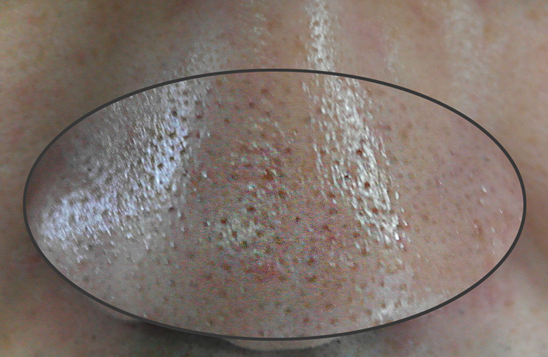 Pikicast版權所有