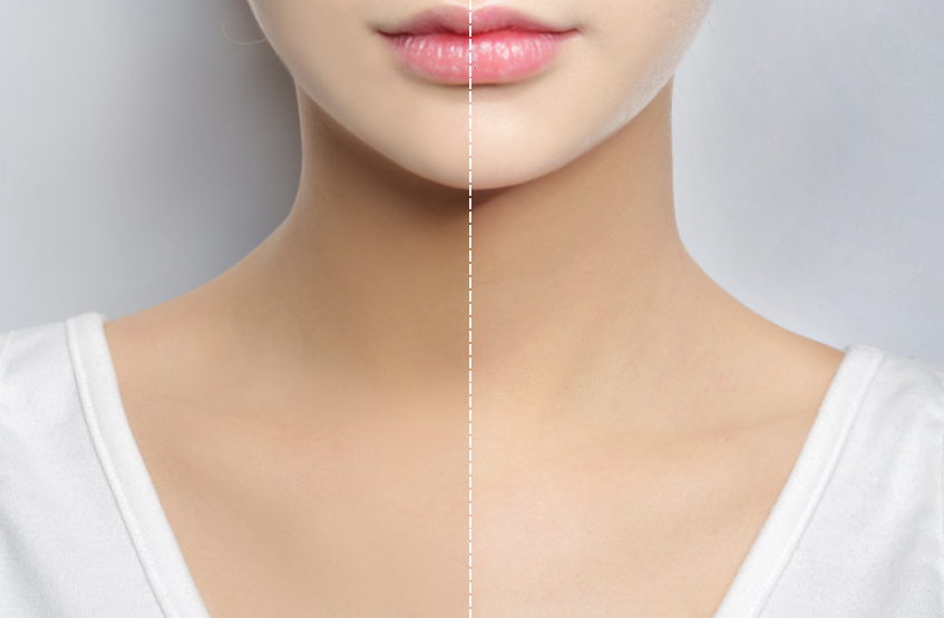 Image Source_stylenanda