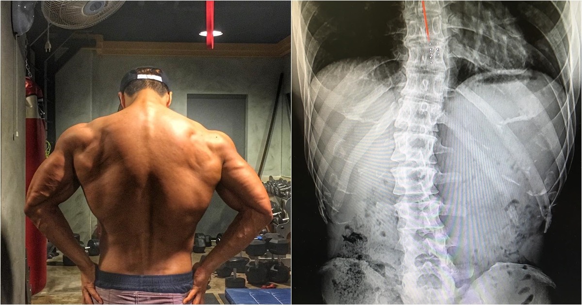 連身材壯碩的老虎金鐘國,其實也是忍傷在主持,因為椎間盤疾患開始健身(必須有肌肉支持,才減少脊椎受力),卻又因為節目讓他受到新的腰傷。忍了三年,其實金鐘國還曾一度有了「想離開節目養傷」的想法,但最後還是為了成員而留下來