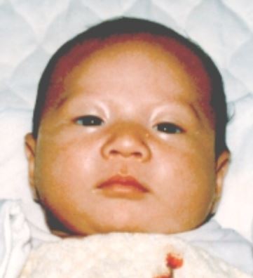 3) Kim Sung Geun (當時0歲,今年31歲)
1986年9月13日下雨天在首爾蘆原區上溪2洞家中失蹤,他在媽媽下樓生火期間被誘拐。
他的媽媽完全不敢相信珍貴的大兒子失蹤,直到30年後的今天依然找不到「雖然不知道什麼理由,現在把兒子還給我也好... 時間過了那麼久了,會原諒他」