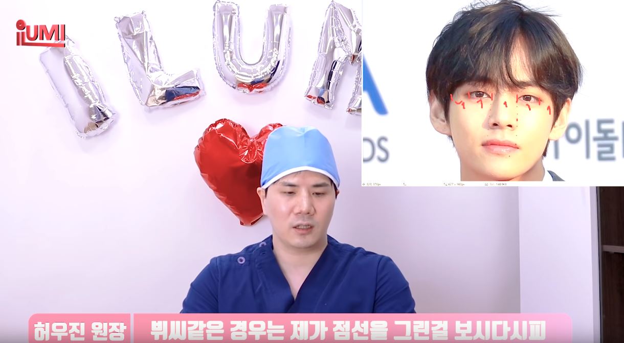 他也提及了V的眼睛瞳孔的位置,嘴唇的長度最好能對上兩邊瞳孔內側,而金泰亨的嘴唇就對的剛剛好呢!醫生還特別稱讚:「真的很了不起呢!」,給了V一個大大的好評XD